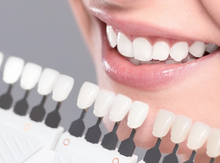 Распространенные причины изменения цвета зубов и эффективные методы удаления