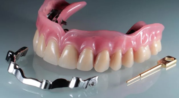 Протезирование: инновации и прогресс в современной стоматологии